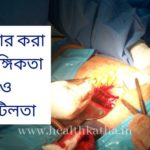 সিজার করা