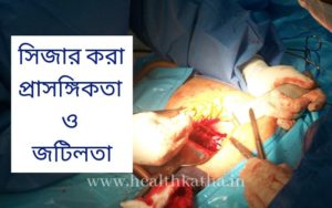 সিজার করা