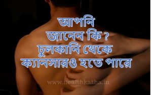 চুলকানি