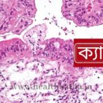 ক্যান্সার
