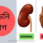 কিডনি রোগ