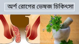 অর্শ রোগের ভেষজ চিকিৎসা