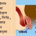 পাইলস