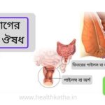 অর্শ রোগের হোমিও ঔষধ