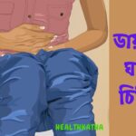 ডায়রিয়ার ঘরােয়া চিকিৎসা
